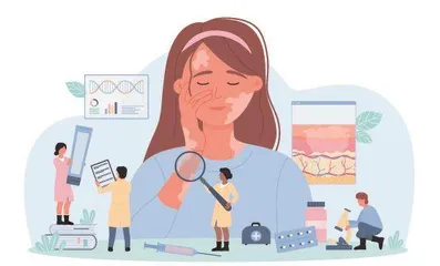 如何摆脱白癜风的困扰