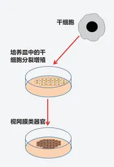 干细胞修好视网膜3