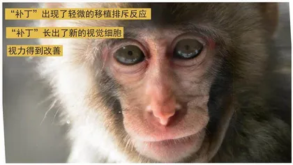 干细胞修好视网膜4