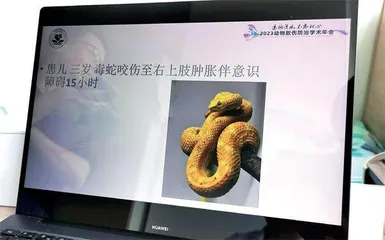 蛇伤诊疗之困1