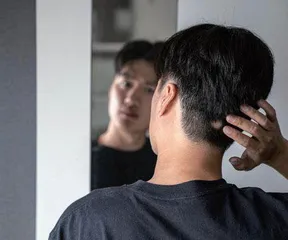 脱发警报，揭开斑秃的神秘面纱