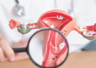 一文看懂，宫颈癌筛查为何重要