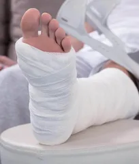 骨折在什么情况下不用手术
