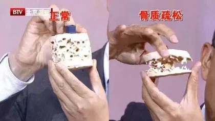 早筛早防，为你健康加『骨』劲2