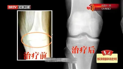 复活身体的“软黄金”1