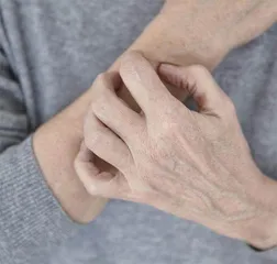 化解皮肤瘙痒危机