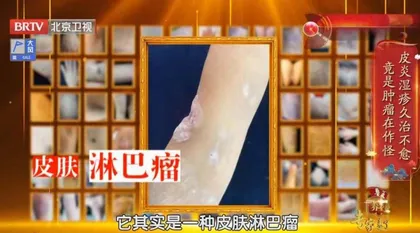 化解皮肤瘙痒危机1