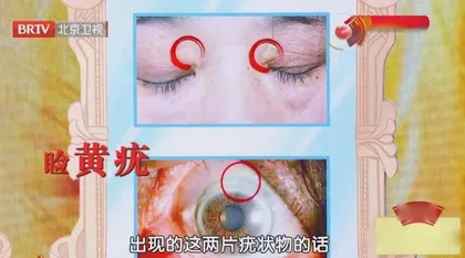 补益气血防衰老3