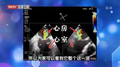 被掩盖的憋闷感,千万要小“心”4