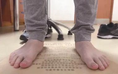 一起了解青少年扁平足