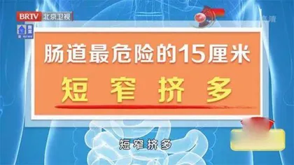“逆转”肠癌的黑科技2