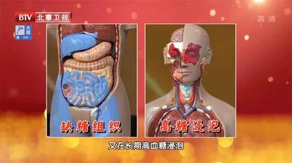 降糖误区藏“陷阱”1