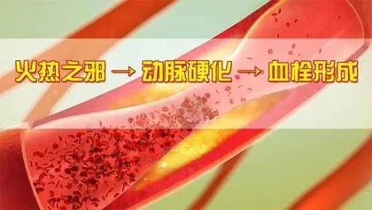 一物三宝助长寿3