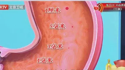 缘何除菌后还会患上胃癌4