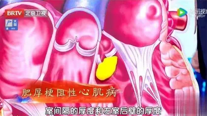 多出来的“致命”肌肉4