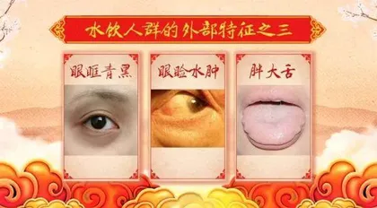 躲在暗处的“伤心”水饮4