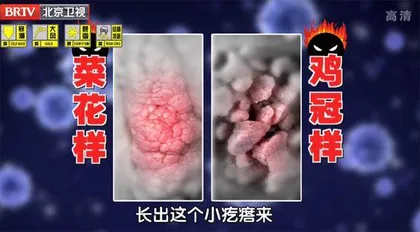 观形辨色识肿瘤5