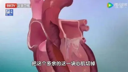 多出来的“致命”肌肉6