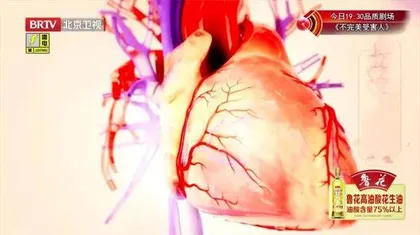 脑卒中却是心作祟1