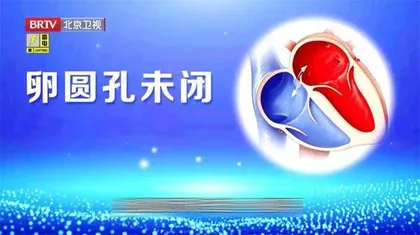 脑卒中却是心作祟2