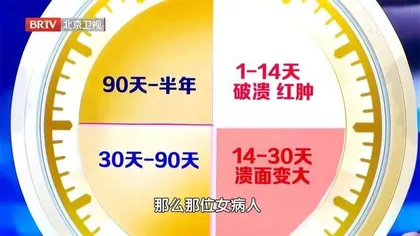 当心致命的口腔溃疡4