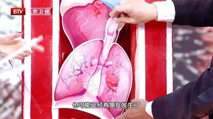 生存期最短的肿瘤6