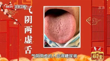 化解糖和癌的亲密危机8