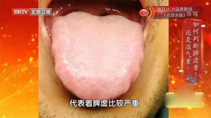 学会给脾胃减负3