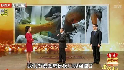 糖友谨防三道坎4