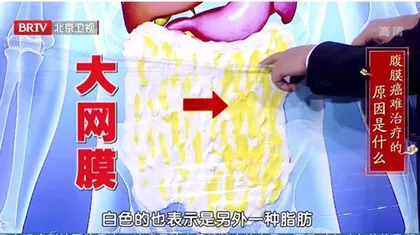 善于伪装的癌中“魔王”