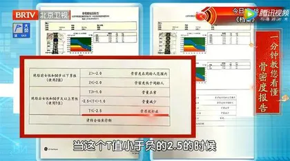 骨骼怎么养才能“返老还童”1