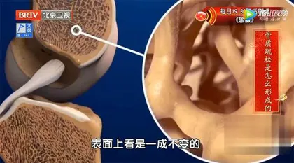 骨骼怎么养才能“返老还童”2
