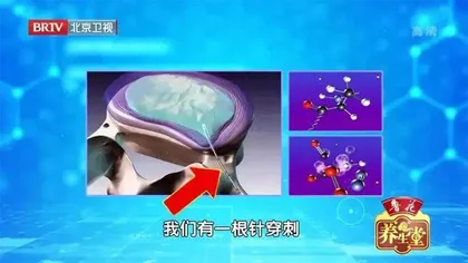 你的腰痛,离瘫痪有多远3