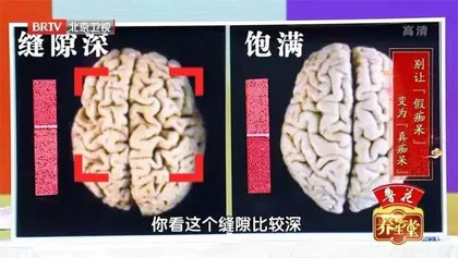 别让“假痴呆”变成“真痴呆”2