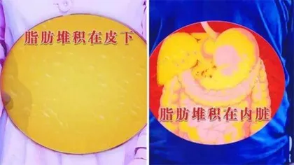 “混”出来的降糖绝招4