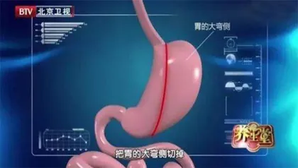 “混”出来的降糖绝招8