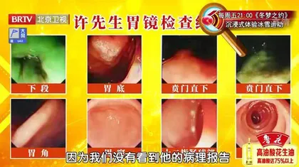 “变化多端”的胃肠肿瘤2