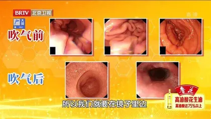 “变化多端”的胃肠肿瘤3