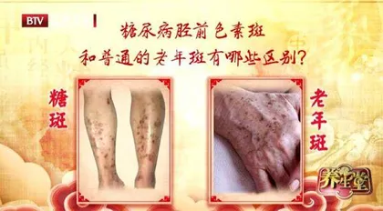 小糖斑背后的大危险3