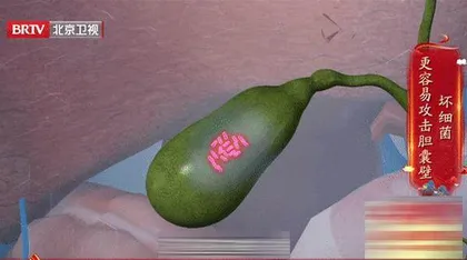 “绕不开”的胆中危机2