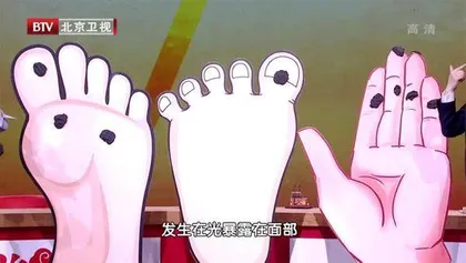 不痛不痒的“坏斑”也是疾病信号2