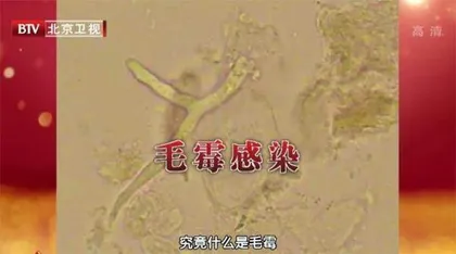 “糖友”需警惕的致命真菌5