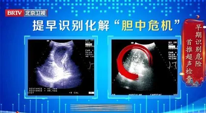 “绕不开”的胆中危机4