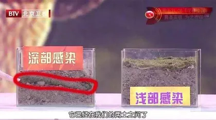“糖友”需警惕的致命真菌6