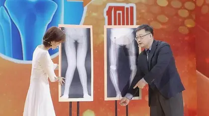 可逆的老年膝5