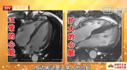 清明养生，护心运动有良方3