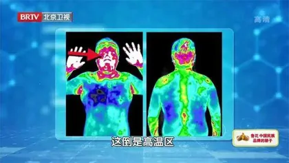 辨清体质巧防病3