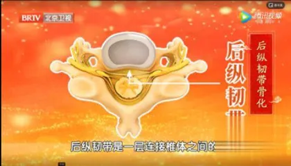 警惕最严重的颈椎病4