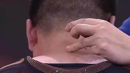 外痒不解内患生2