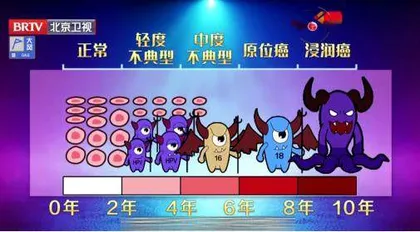 阻断HPV,男女共担责1
